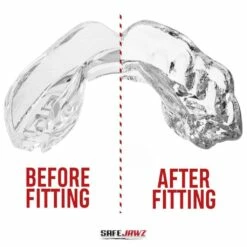 SafeJawz Intro Mouth Guard Clear -REFLEX Sales Shop safejawz intro mouth guard clear 3 4176 p