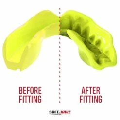 SafeJawz Intro Mouth Guard Fluro Yellow 8 SafeJawz Intro Mouth Guard Fluro Yellow -REFLEX Sales Shop safejawz intro mouth guard fluro yellow 3 8438 p