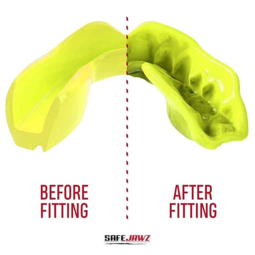 SafeJawz Intro Mouth Guard Fluro Yellow 5 SafeJawz Intro Mouth Guard Fluro Yellow - Image 3